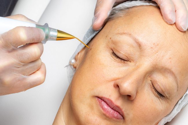 Plasma Pen for Skin Tightening in Richardson, TX - Premier Med Spa