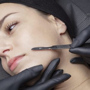 Special Offers dermaplaning