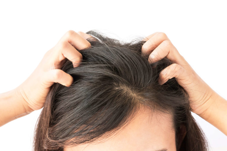 Keravive: Care For Your Scalp Health With This Treatment