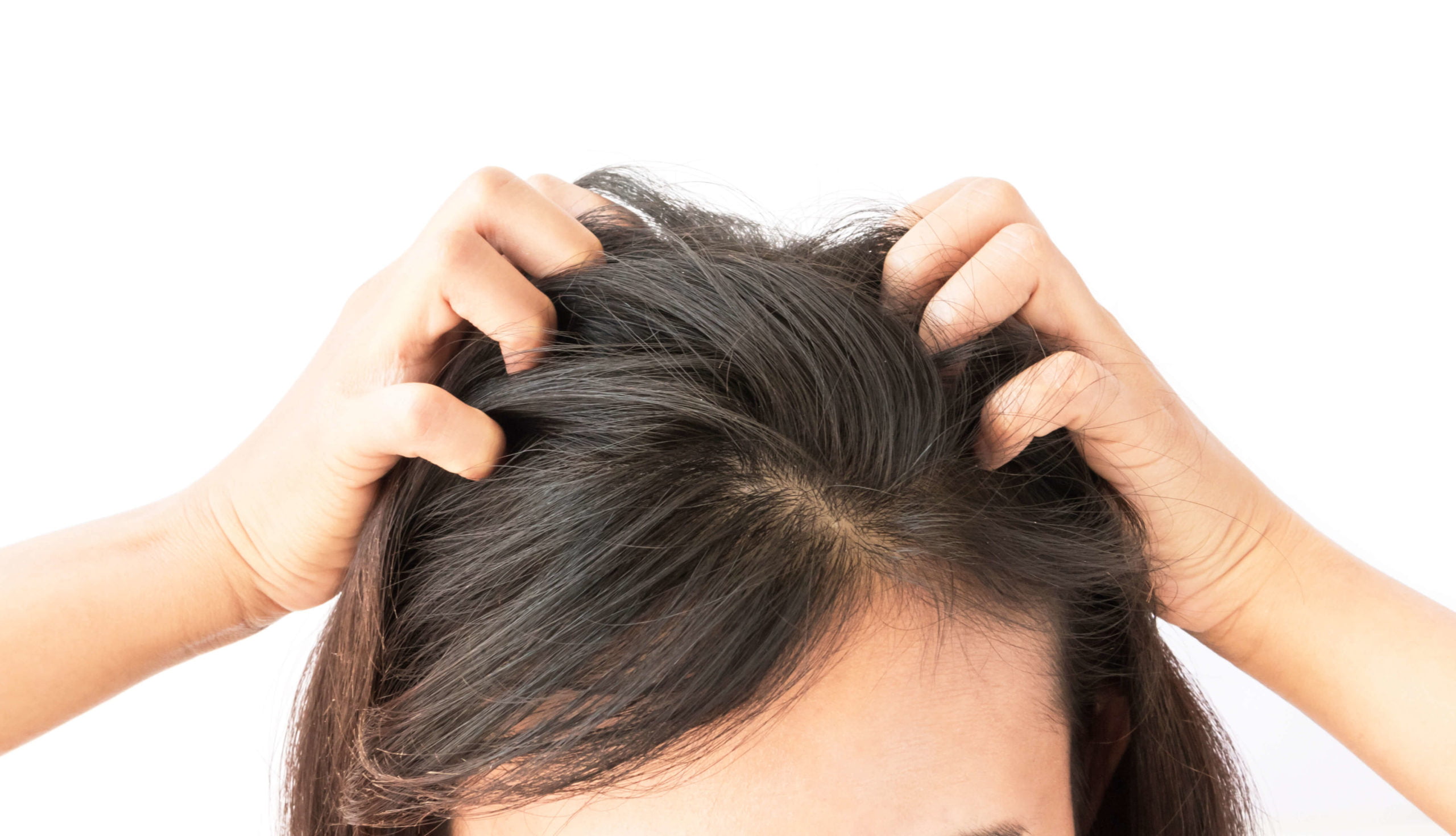 Keravive: Care For Your Scalp Health With This Treatment