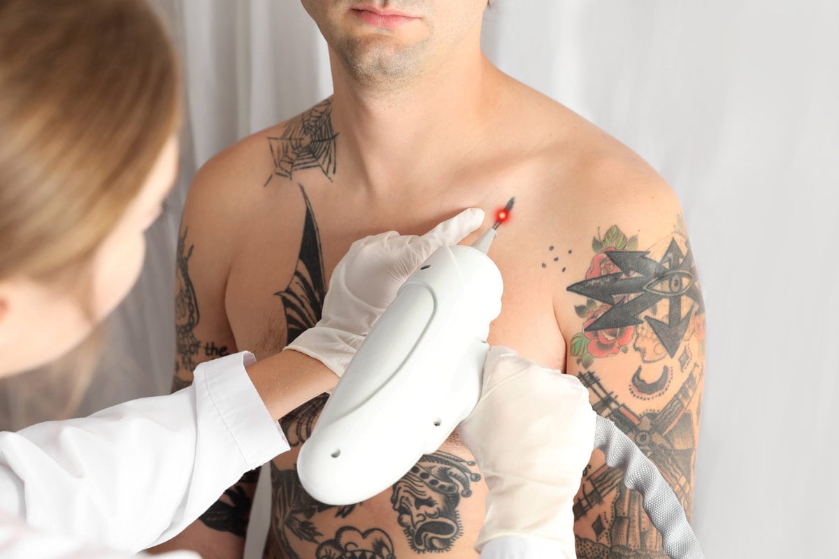 Permanent Tattoo Removal Treatment | Premier Medspa in Texas