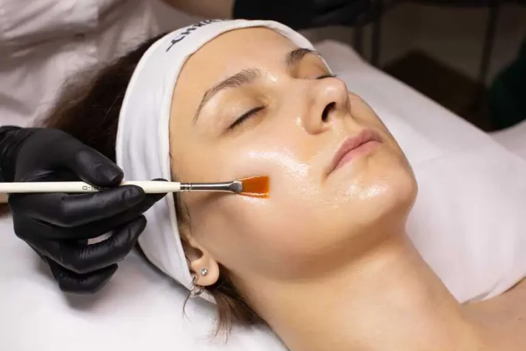 Chemical Peels Treatment In Richardson, TX by Premier Med Spa