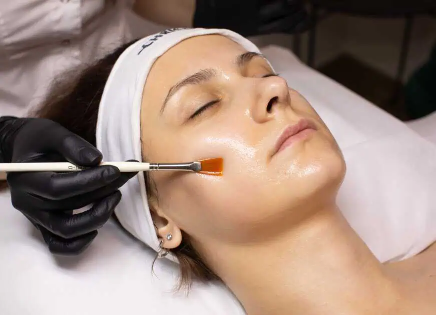 Chemical Peels Treatment In Richardson, TX by Premier Med Spa