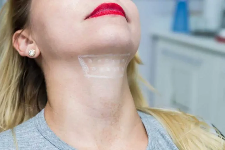 Kybella Treatment in Richardson, TX by Premier Med Spa