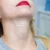 Kybella Treatment in Richardson, TX by Premier Med Spa